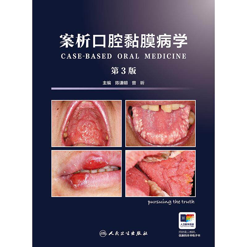案析口腔黏膜病学 第3版 陈谦明 曾昕主编 粘膜病临床案例诊治教程 口腔医学参考工具书籍 口腔科学 人民卫生出版社 9787117368889