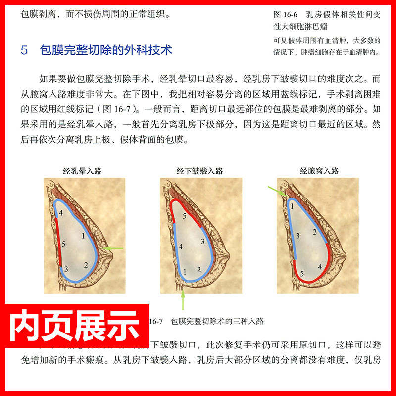 正版乳房美容外科原则理念技术图谱 医医图书外科学