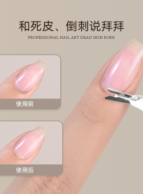 卡妞死皮叉美甲去死皮角质V型