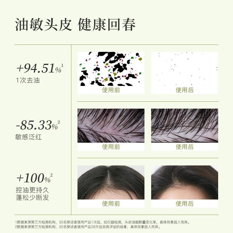 自漾头皮清洁油预洗油 净化控油舒缓防断润发滋养 改善头发头皮油,淘宝优惠券,粉丝福利购,淘宝优惠卷