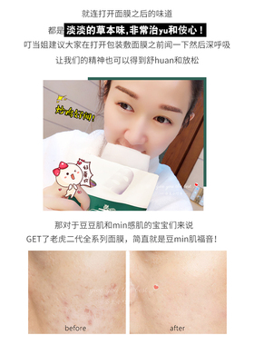 韩国vt老虎面膜二代双倍双效6片