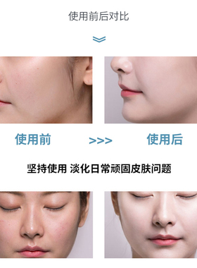 悠纪玻尿酸烟酰胺安瓶精华水补水