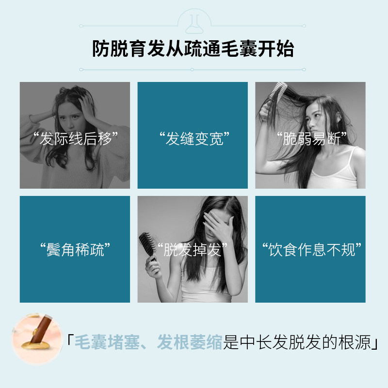 云南白药养元青控油防脱发女育发液 养元青洗发水