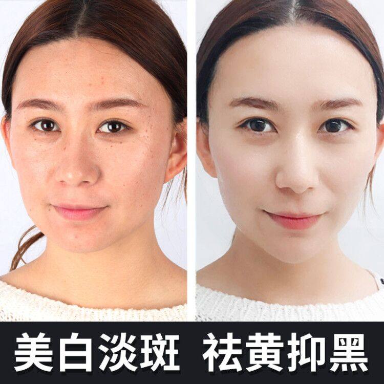 珀莱雅补水美白专柜品牌 珀莱雅夺慕面部护理套装