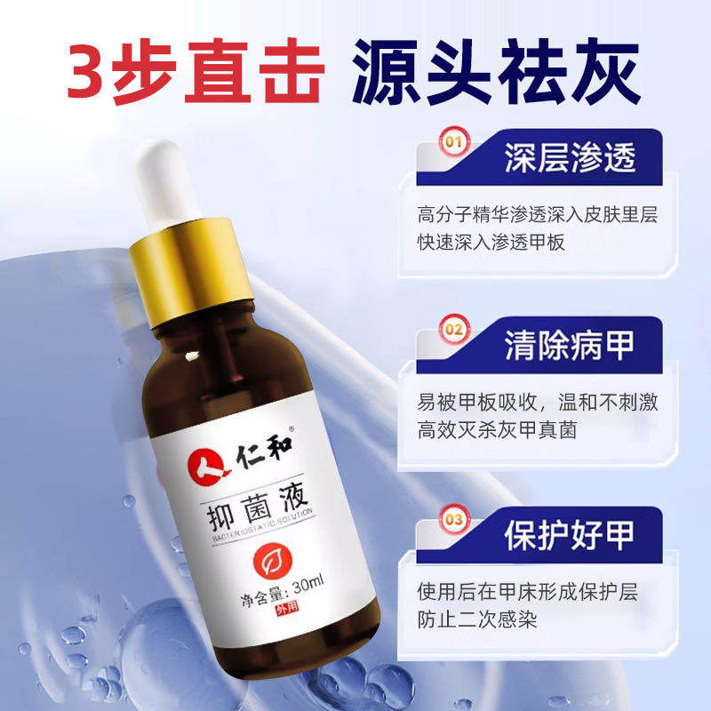 仁和灰甲护理液抑医用级灰指甲强效菌液变色亮甲正品专用喷雾剂 - 图1