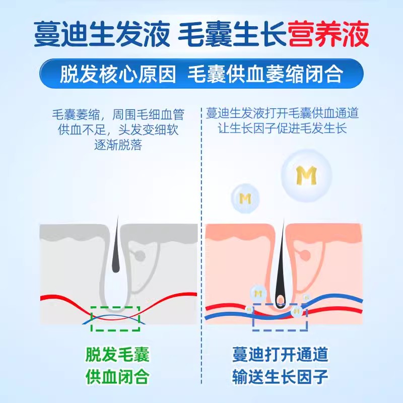 蔓迪米诺地尔酊90ml*4瓶男用脱发曼迪米诺地尓酊正品官方旗舰店