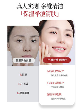 水杨酸淡痘面膜改善痘印泛红舒缓修护去闭口粉刺敏感肌控油提亮女