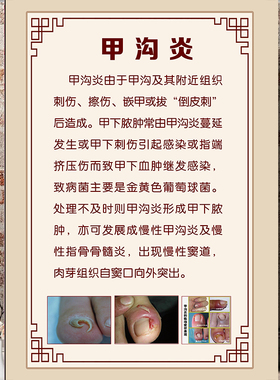 休闲洗脚店专业风足浴装饰挂画