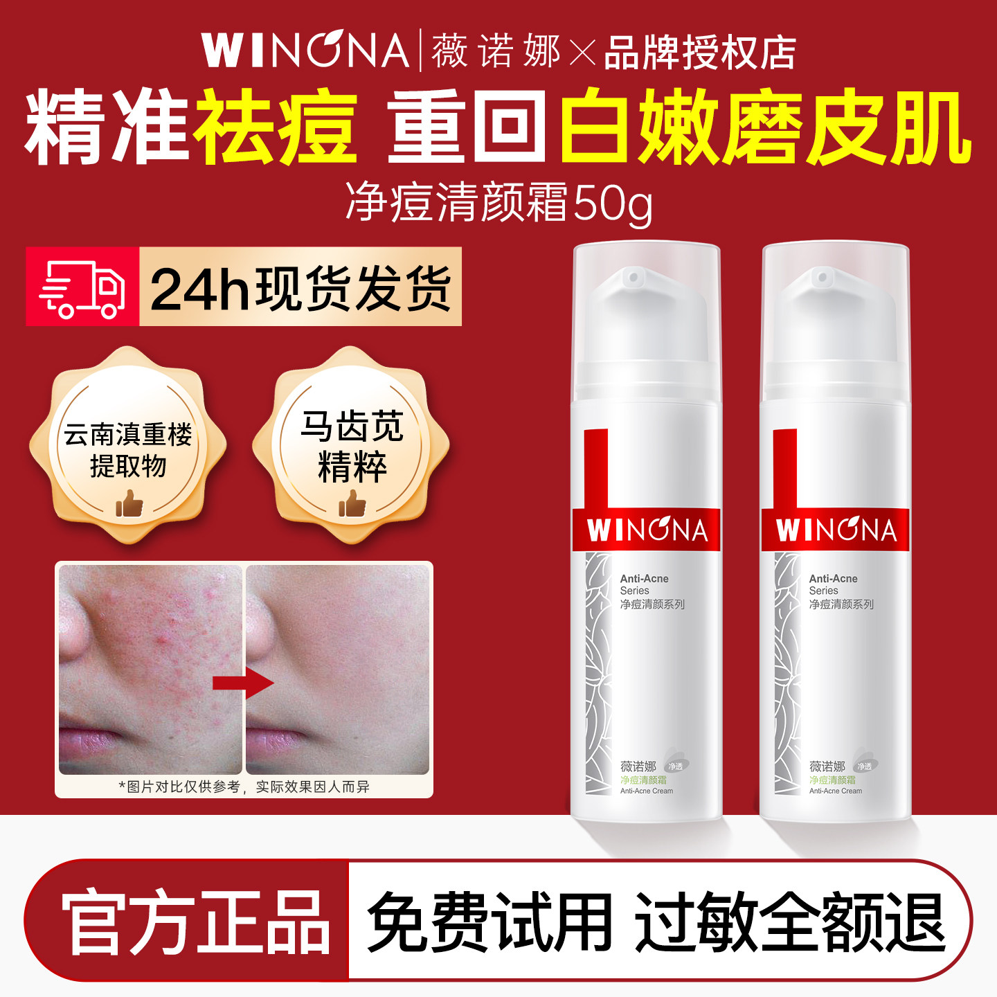 薇诺娜净痘清颜霜50g祛痘抑痘舒缓修护油痘敏感保湿面霜官方正品