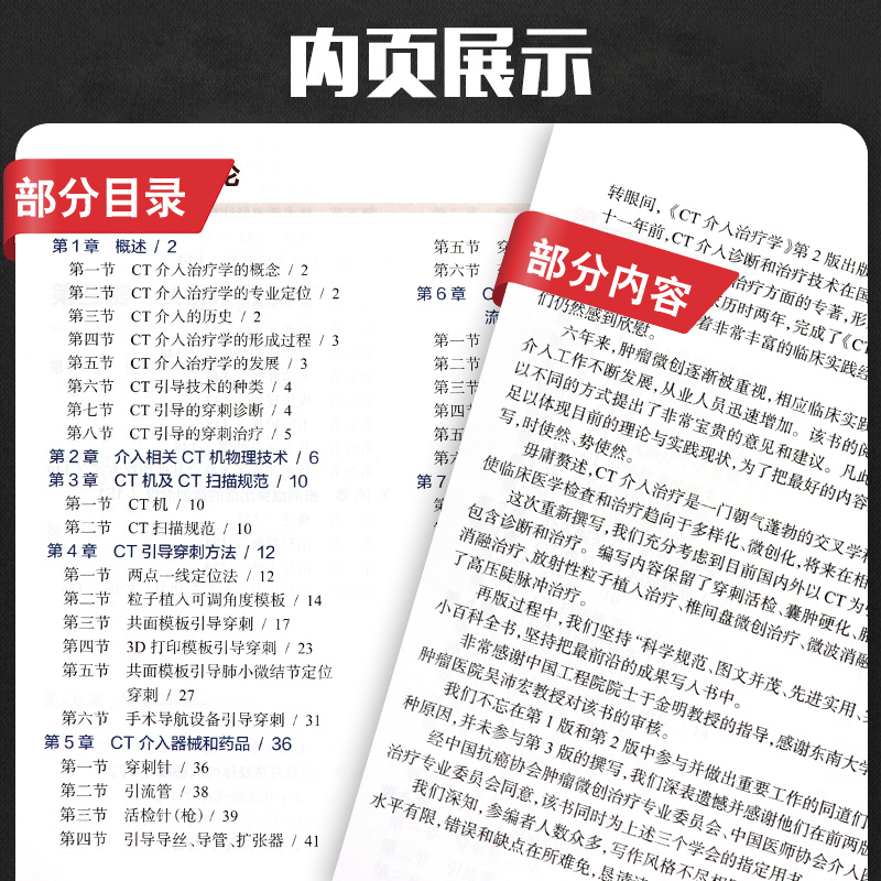 CT介入治疗学第三3版胡效坤张福君肖越勇医学影像ct适应症介入医学鼻咽癌甲状腺颈部淋巴肺部肿瘤乳腺肿瘤肝癌肾癌子宫颈癌直肠癌