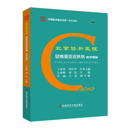 北京协和医院疑难重症皮肤病自身 久久旺图书皮肤病学/性病学