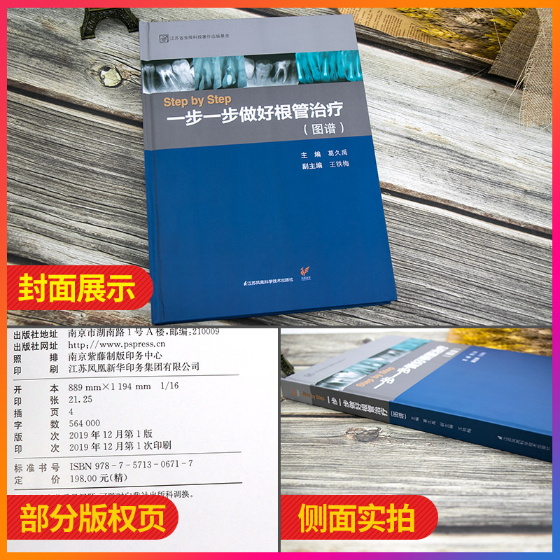 正版 StepbyStep一步一步做好根管治疗 图谱 葛久禹 王铁梅 主编 口腔科口腔医学 根管治疗书籍 江苏科学技术出版社9787571306717 - 图0