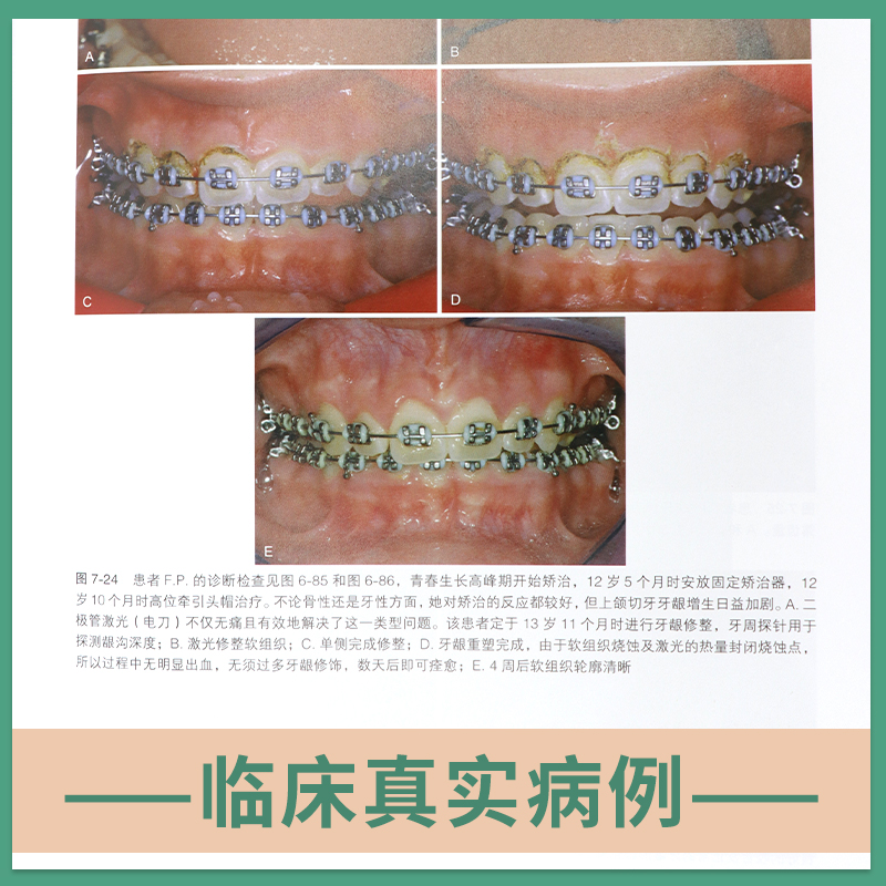 官方正版当代口腔正畸学原著第六版6版王林严斌爱思唯尔口腔正畸书籍专科教程书策略控制与技巧现代病例临床治疗设计美学修复-图1