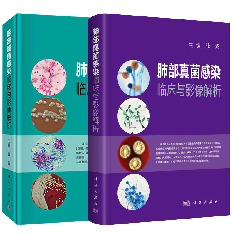 正版2本 肺部细菌感染临床与影像解析+肺部真菌感染临床与影像解析 张嵩 主编 科学出版社 影像医学参考书 肺部影像诊断和鉴别诊断