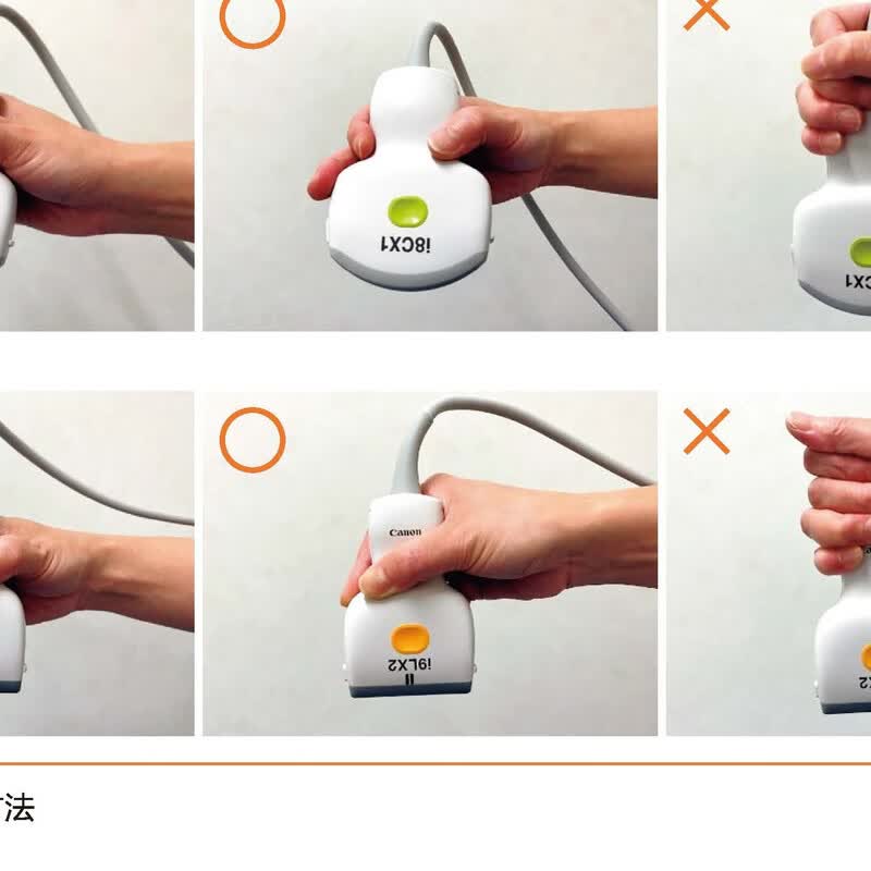 超声解剖及扫查技巧图解 诊断学医学影像图谱人体断层彩超书籍正常值测量备忘录技术入门b超血管肌骨心超笔记腹部精细讲解心脏动图