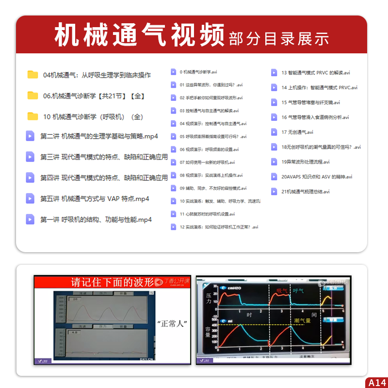 正版5本 呼吸机波形快速解读+机械通气+ECMO实操手册+机械通气基本技术+ECMO临床应用附典型病例及操作视频 体外肺氧合ICU重症监护