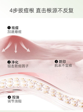 祛痘精油无激素控油适用脸长痘