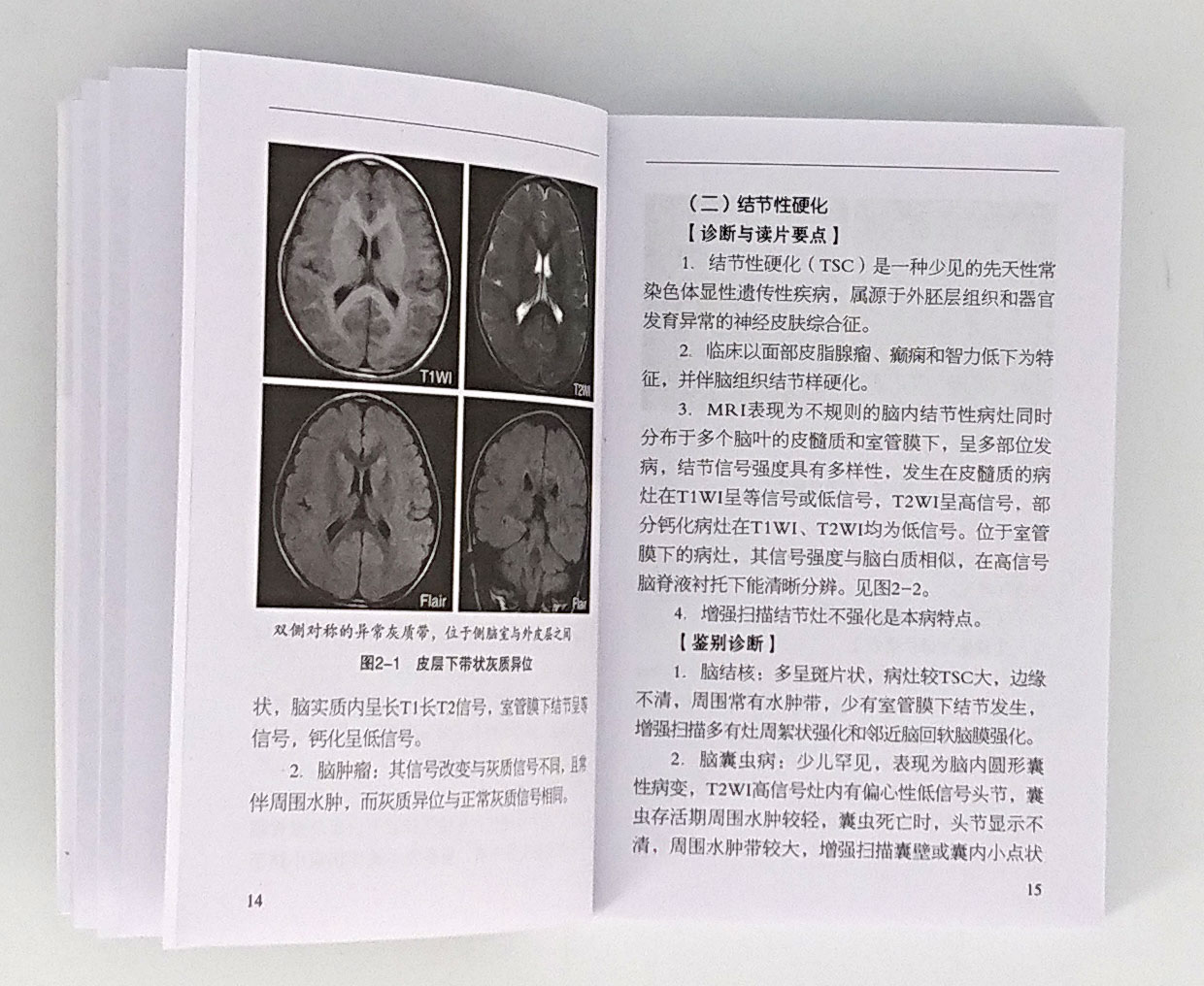 临床实用MRI掌中宝临床实用掌中宝系列第4本科学简明实用临床宝典便携小册子口袋书核磁共振诊断学影像诊断学影像解剖图谱书籍-图1