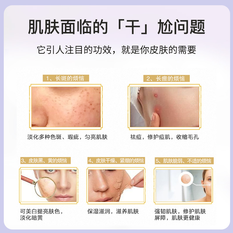 片仔癀珍珠膏皇后牌美白面霜淡斑祛斑霜保湿补水旗舰店官方正品