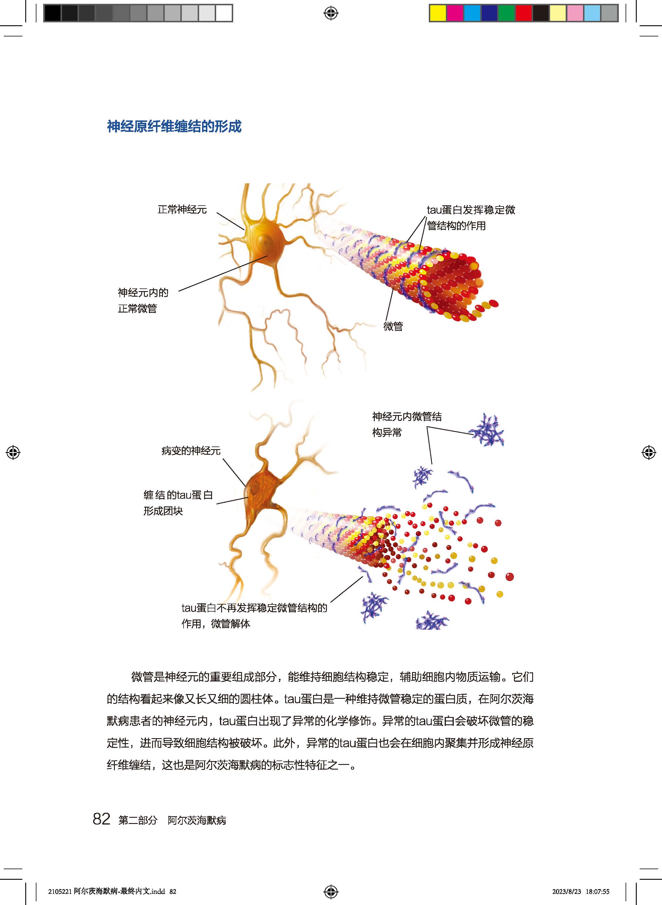 阿尔茨海默病全书 给认知障碍患者和照护者的专业指南 高晶 主译 阿尔茨海默病 照护 痴呆认知障碍 北京科学技术出版9787571430764