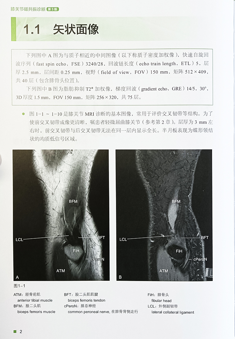 膝关节磁共振诊断 第3版 骨肌影像诊断技巧丛书 日 新津守 著 新增软骨的成像方法 类风湿关节炎等 北京科学技术出版9787571432829 - 图3