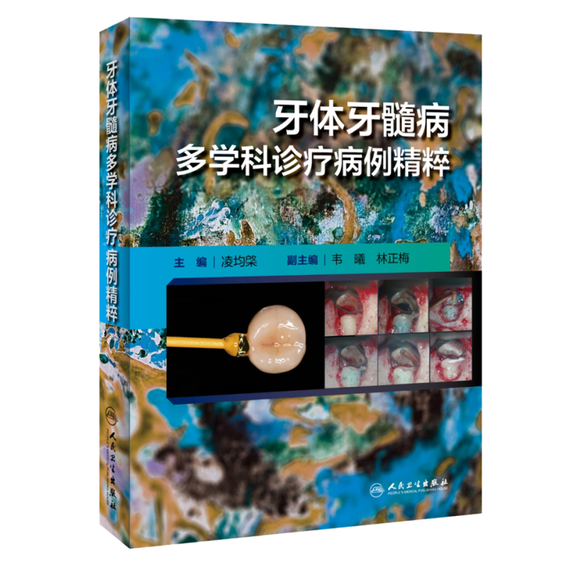 牙体牙髓病多学科诊疗病例精粹 凌均棨主编 口腔科学临床病例多学科讨论诊断治疗过程方案操作流程 人民卫生出版社9787117359917