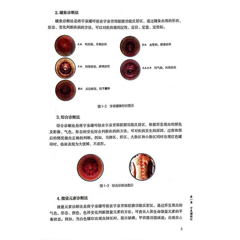 中华宇泉罐诊罐疗秘要 李玉泉 拔罐灌灸灌针注药作用机制操作方法 中医临床实践入门医学书籍内外妇儿骨科皮肤科 中国中医药出版社