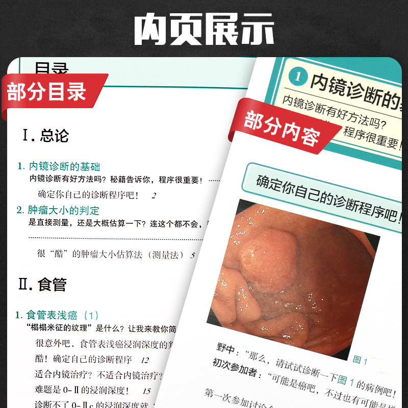 上消化道内镜诊断秘籍 日 野中康一 食管表浅癌Barrett食管腺癌胃溃疡早期胃癌鉴别诊断书籍 内镜诊断与鉴别诊断图谱辽宁科技出版