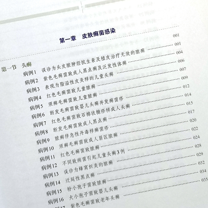 疑难少见真菌病例 温海主编 临床医学皮肤性病学皮肤科感染科呼吸科检验科的医务人员医学生 9787547848036 上海科学技术出版社 - 图2