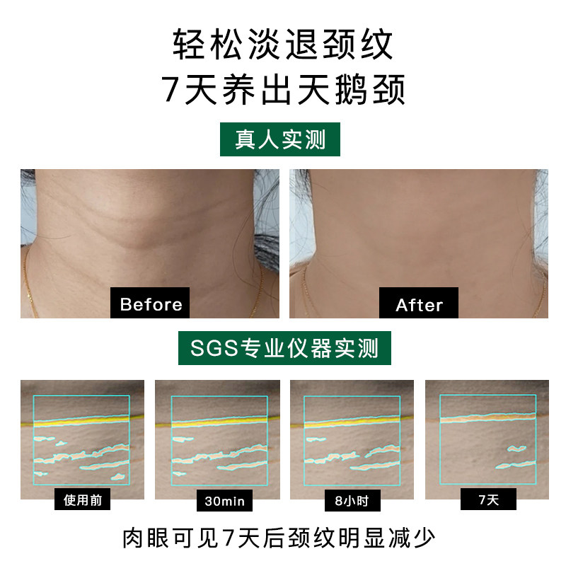 德国佰奥德BIOMD焕龄时光童颜油30ml面部K皱淡纹紧致提亮抗光老 - 图3