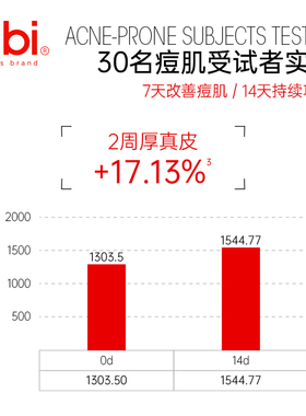瑞士bibi青少年祛痘精华乳液温和控油淡化痘印男女学生高中生抗痘