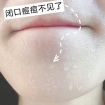 (Remove the face 99% Dirty Things) Facial Cleansing Pores Face With Mites Ginseng Soap Buy Two Deliver One