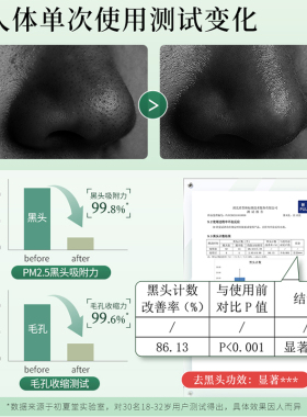 深层清洁黑头控油粉刺痘痘初夏堂