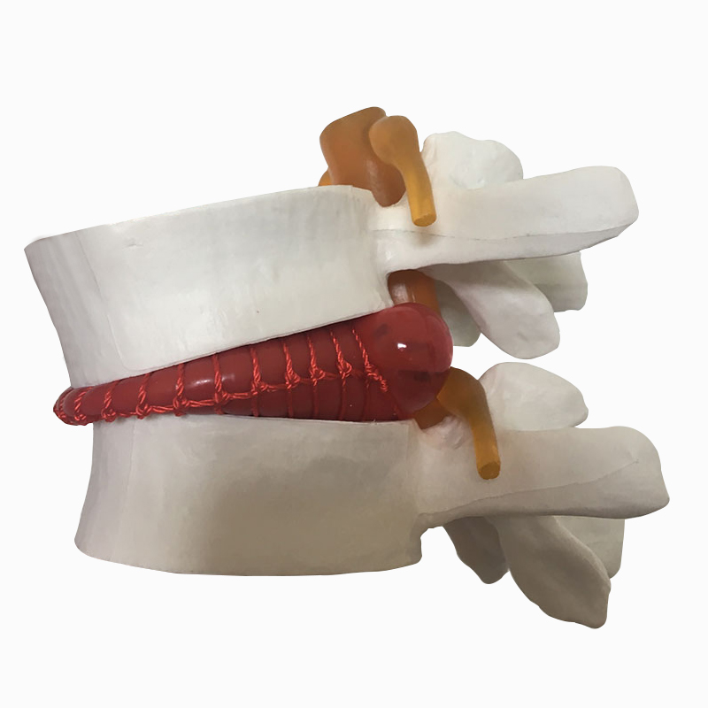 二三四五节腰椎模型骨盆人体骨骼盆骨椎间盘突出演示尾骨医用脊椎 - 图3
