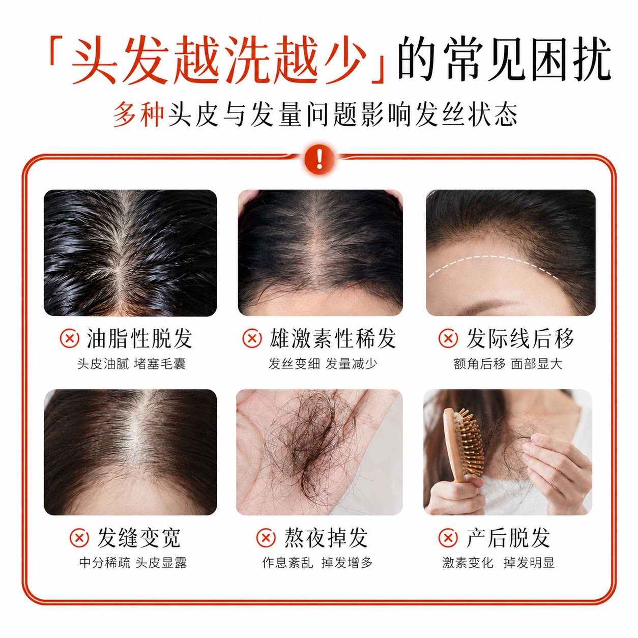 【拍1发2】韩纪防脱固发洗发水