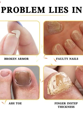 NailsRepairEssencegel