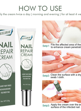 NailFungusTreatmentCream