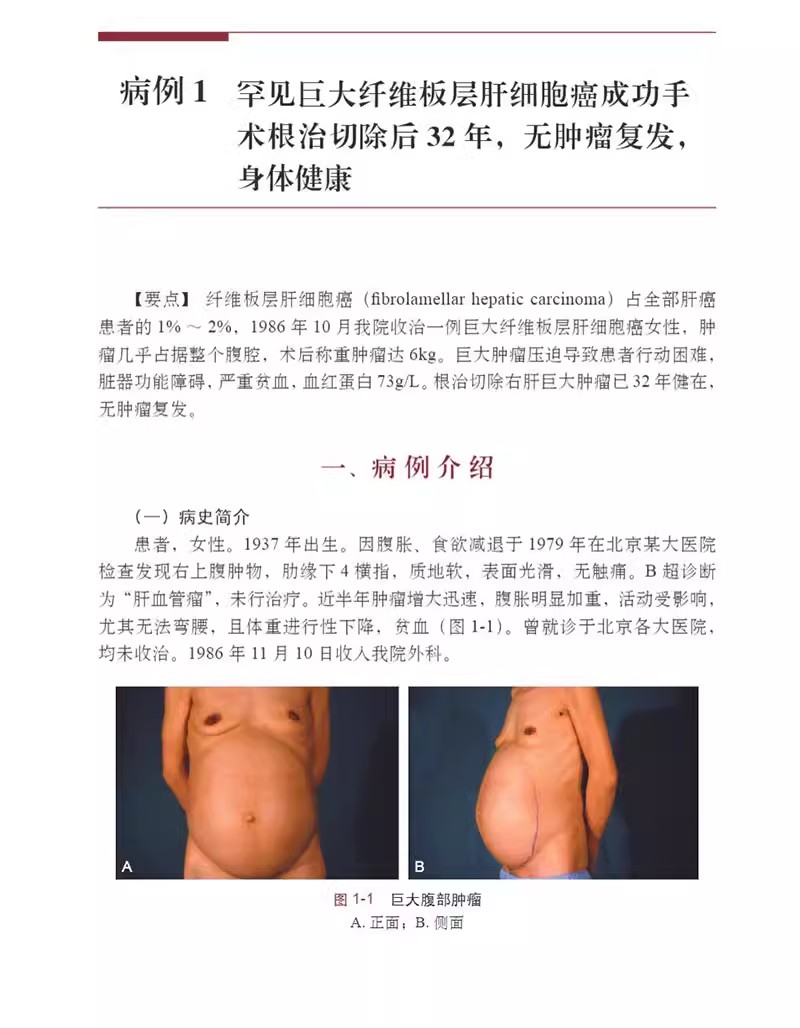 放军总医院临床病例精粹 第3辑 消化道癌肺癌专辑 存活10年以上 顾倬云 解放军总医院专家对病例的讨论及点评 科学出版社