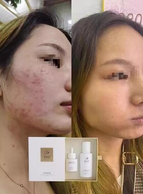 黛姿颜肌源赋活套专业修复敏感肌
