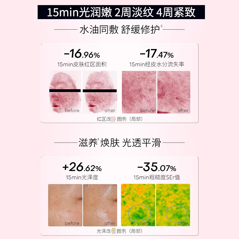 以油养肤！夸迪水油双仓面膜双锁花萃山茶花油敷5D玻尿酸补水面膜 - 图2