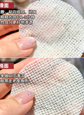 瑕疵皮抛光嫩肤~ddg五酸棉片水杨酸去果酸去痘印闭口粉刺温各刷酸
