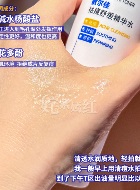 新品 平衡痘肌微生态~敷尔佳祛痘舒缓精华水乳液套装控油修护补水