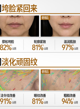 NACO高浓度专利玻色因面霜紧致抗皱淡化细纹保湿补水滋润