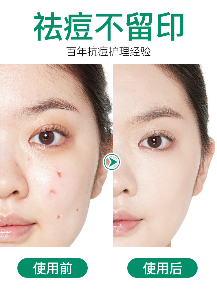 曼秀雷敦豆豆贴修复去隐形痘痘贴 曼秀雷敦美妆面部护理套装