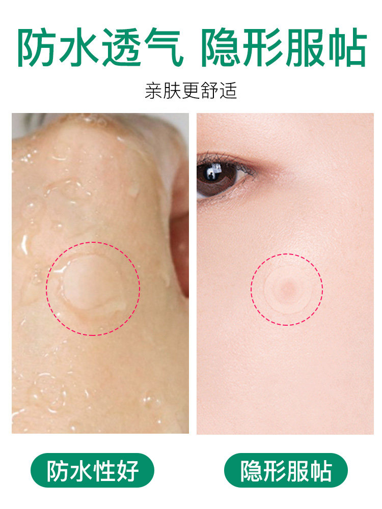 曼秀雷敦豆豆贴修复去隐形痘痘贴 曼秀雷敦美妆面部护理套装