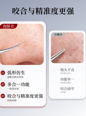 美容师专用拔去暗疮神器粉刺针