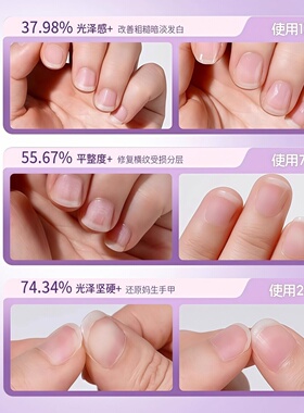 三合一美甲精华笔修甲护甲指缘呵护营养液受损护理油日常甲面护理