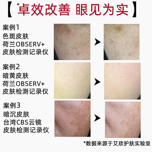 艾诗可因祛黄美白淡斑精华素亮肤素377维C精华油点阵皮秒色沉反黑 - 图0