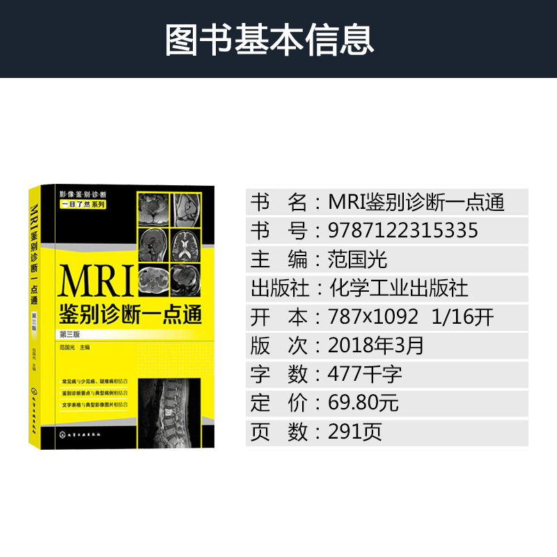 MRI鉴别诊断一点通 mri影像诊断mri诊断与临床mri基础mri检查技术医学影像诊断学医学影像学读片诊断图谱导图式医学影像鉴别诊断书-图1