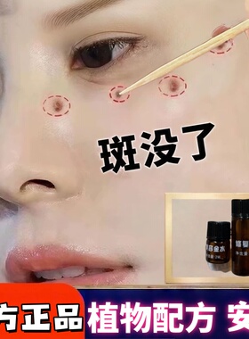 【植物配方】官方正品美容院同款点斑美容金水修复液雀斑晒斑黑点